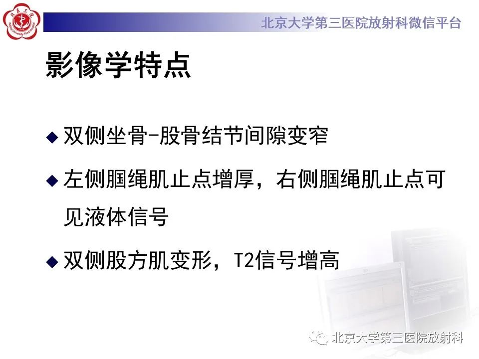 影像PPT - 【PPT】坐骨—股骨撞击综合征-4