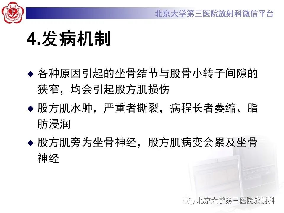 影像PPT - 【PPT】坐骨—股骨撞击综合征-9