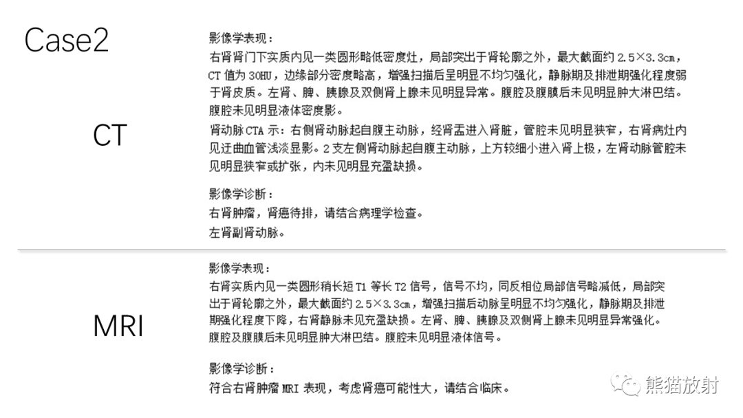 影像PPT - 【病例】肾（周）脓肿 VS 肾透明细胞癌-21
