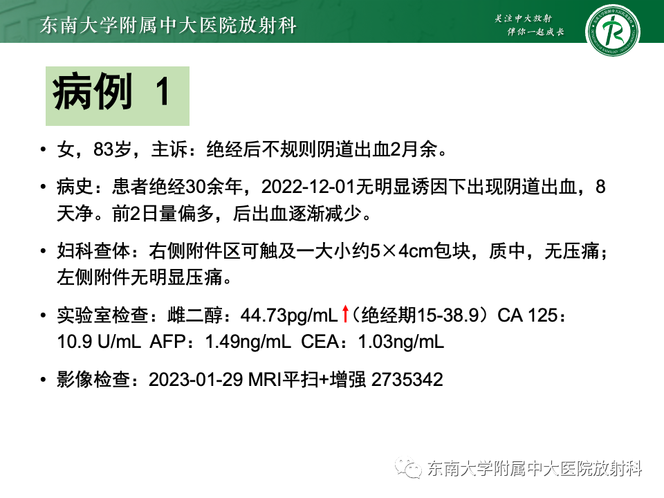 影像PPT - 【PPT】卵巢颗粒细胞瘤-2