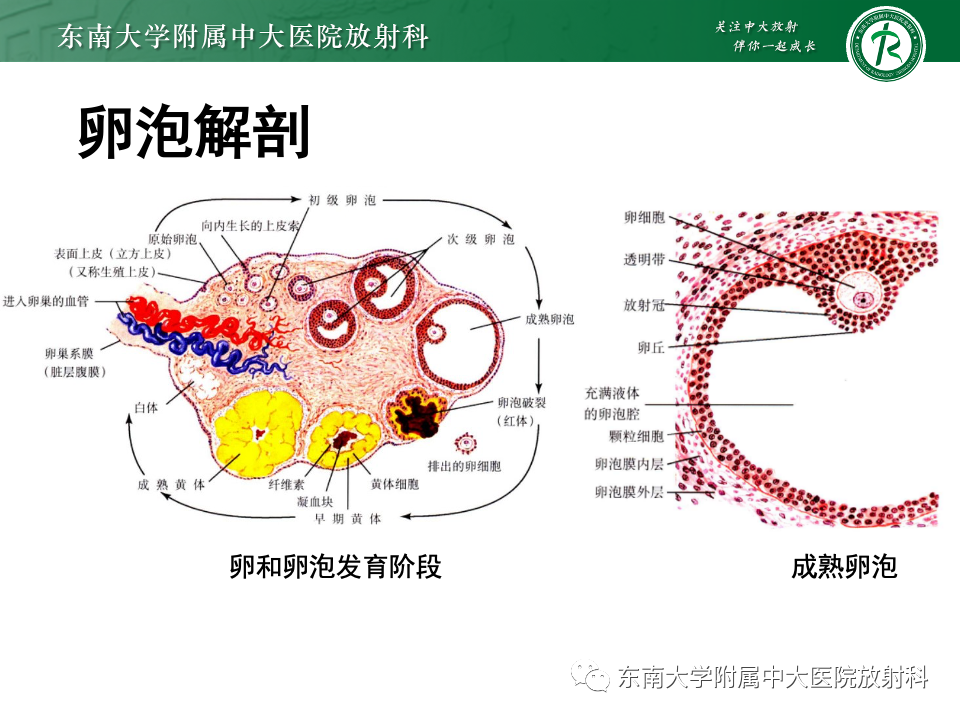 影像PPT - 【PPT】卵巢颗粒细胞瘤-7