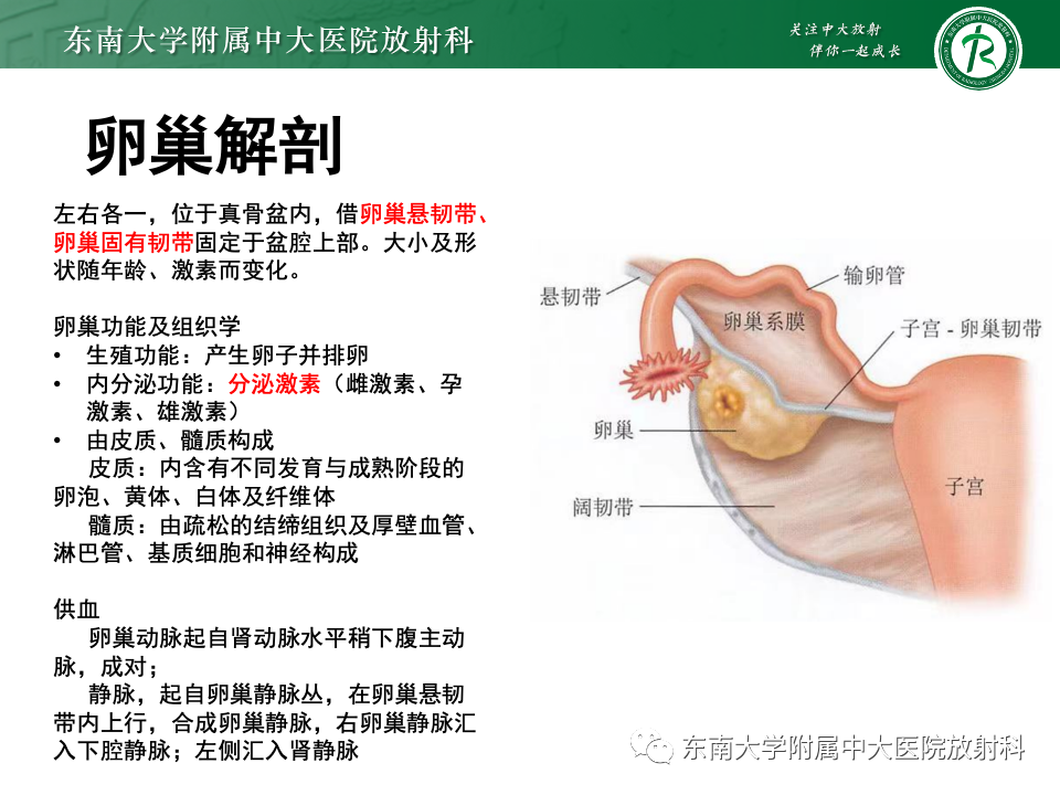 影像PPT - 【PPT】卵巢颗粒细胞瘤-6
