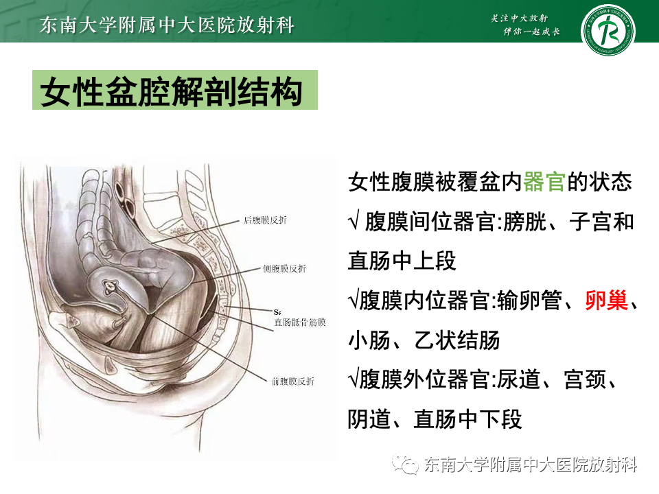 影像PPT - 【PPT】卵巢颗粒细胞瘤-9
