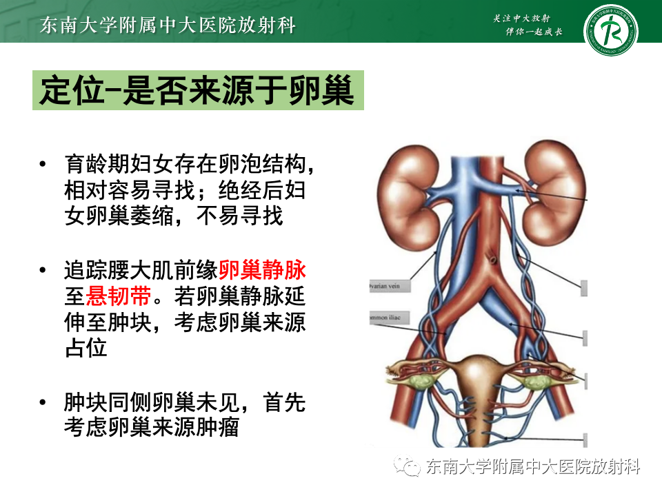 影像PPT - 【PPT】卵巢颗粒细胞瘤-12