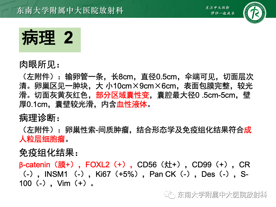 影像PPT - 【PPT】卵巢颗粒细胞瘤-25
