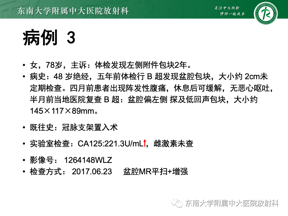 影像PPT - 【PPT】卵巢颗粒细胞瘤-27