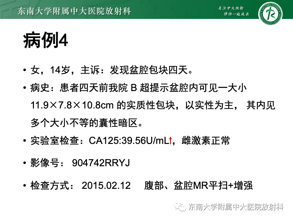 影像PPT - 【PPT】卵巢颗粒细胞瘤-34