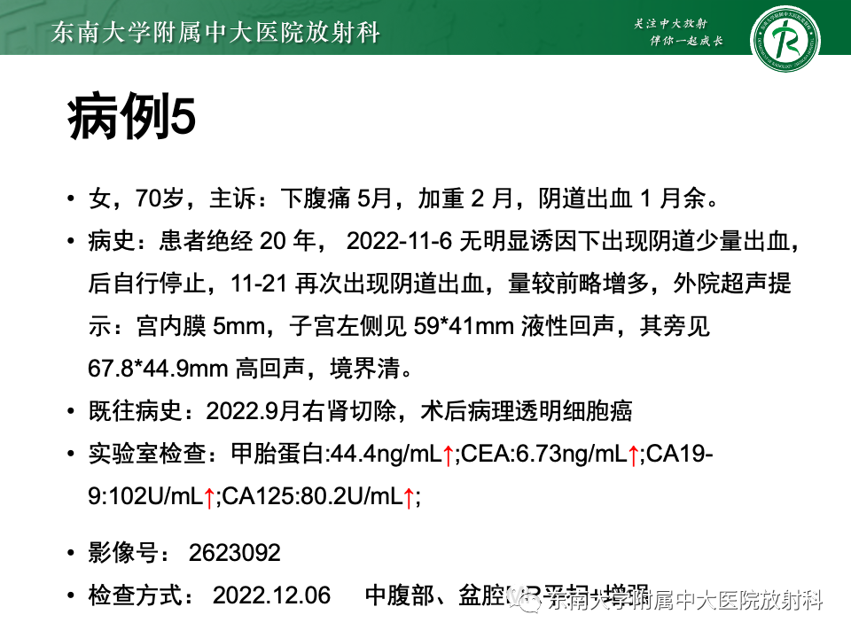影像PPT - 【PPT】卵巢颗粒细胞瘤-38
