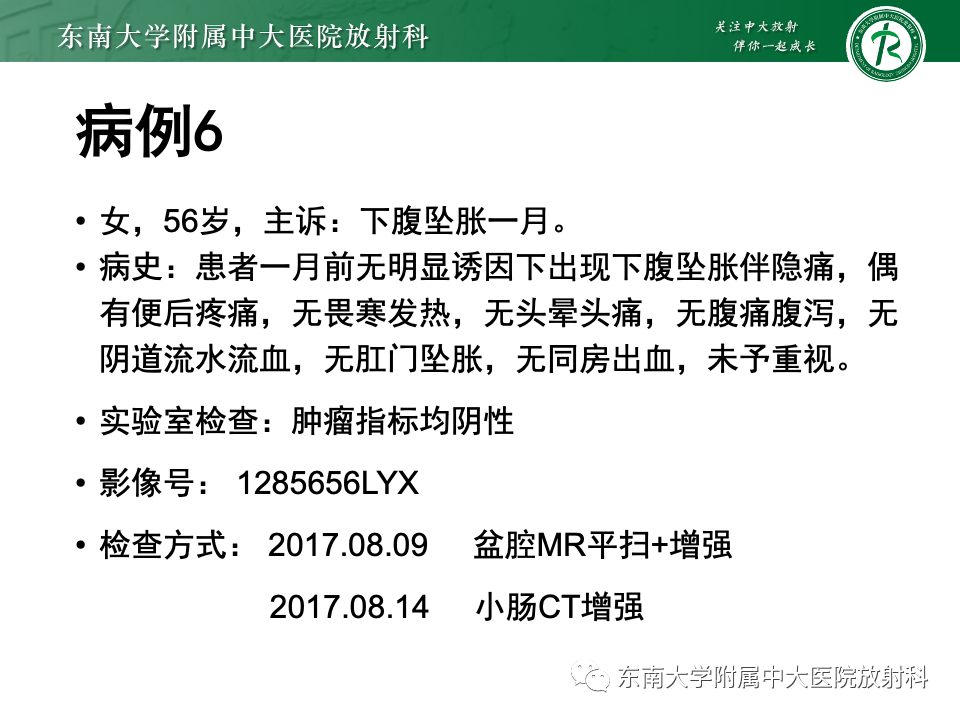 影像PPT - 【PPT】卵巢颗粒细胞瘤-43