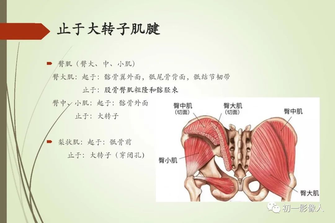影像PPT - 大转子疼痛综合征2例MR影像-4