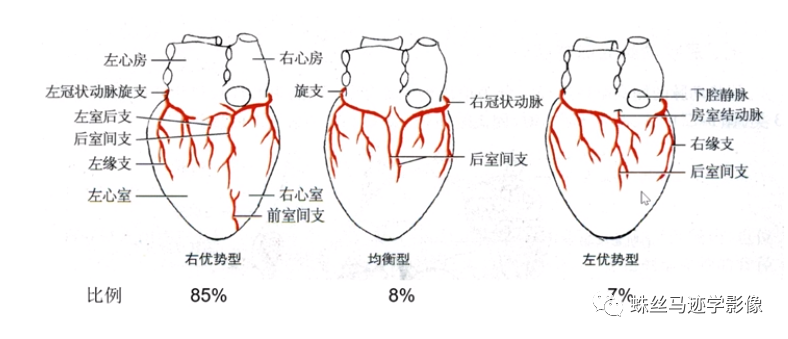 影像PPT - 冠状动脉详细解剖及变异-4