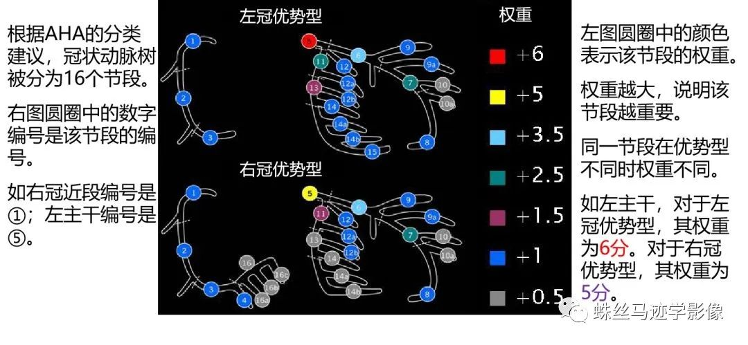 影像PPT - 冠状动脉详细解剖及变异-6