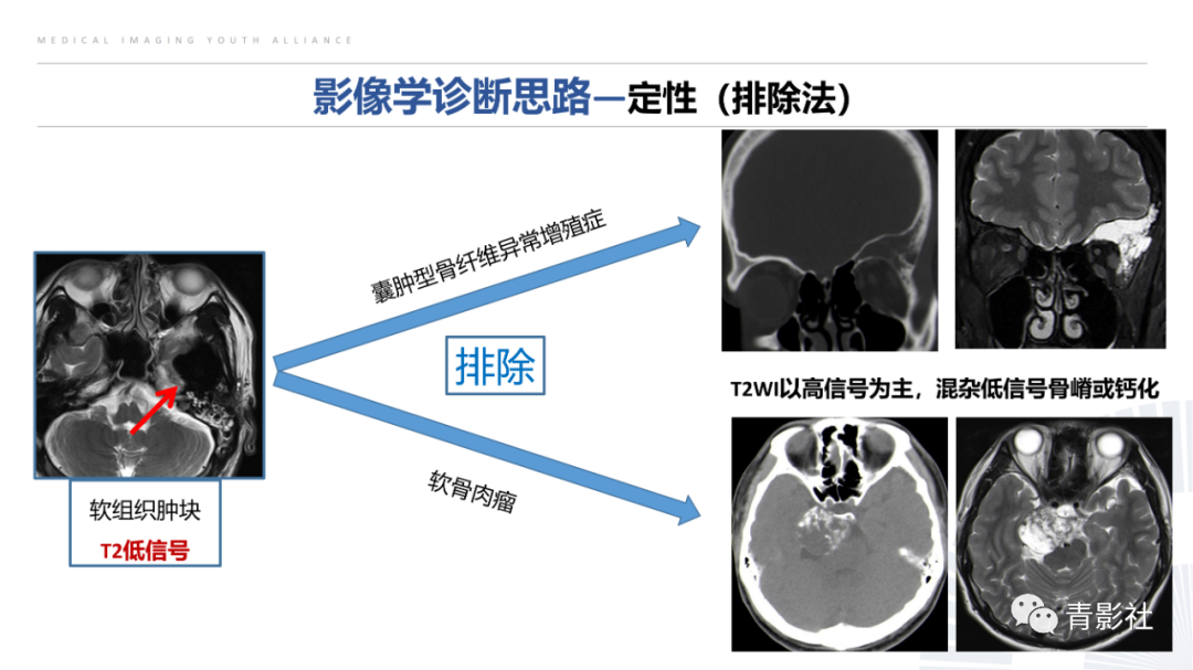 影像PPT - 【病例】蝶骨巨细胞修复性肉芽肿1例CT及MR影像-11
