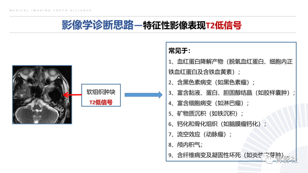 影像PPT - 【病例】蝶骨巨细胞修复性肉芽肿1例CT及MR影像-10