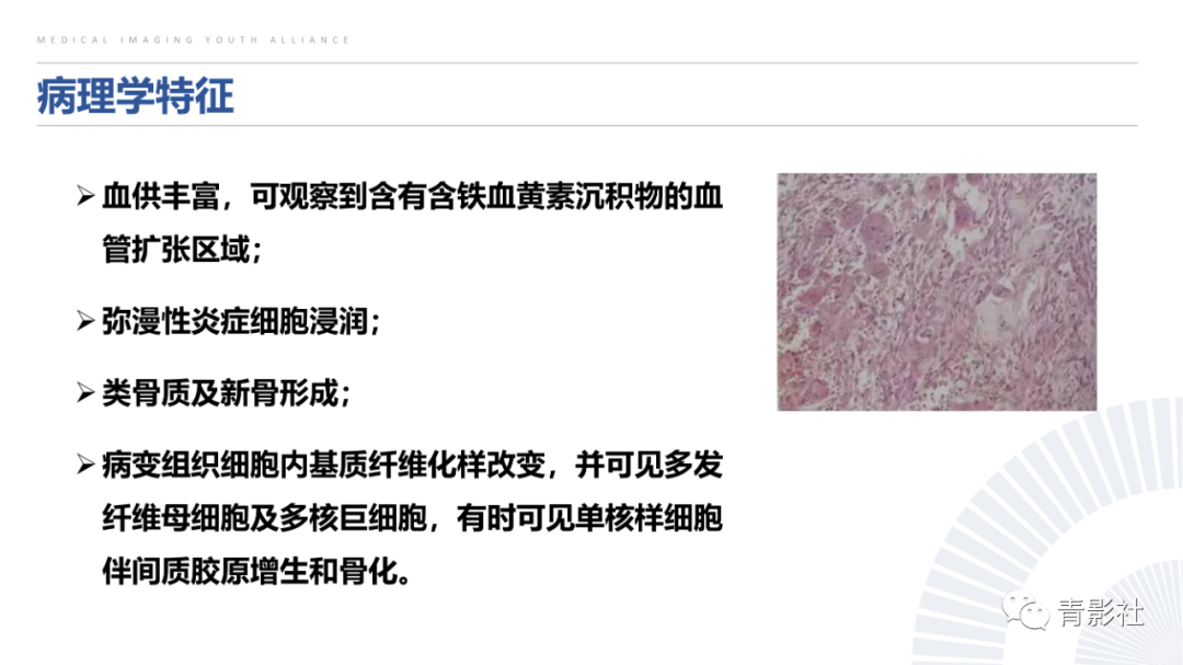 影像PPT - 【病例】蝶骨巨细胞修复性肉芽肿1例CT及MR影像-17