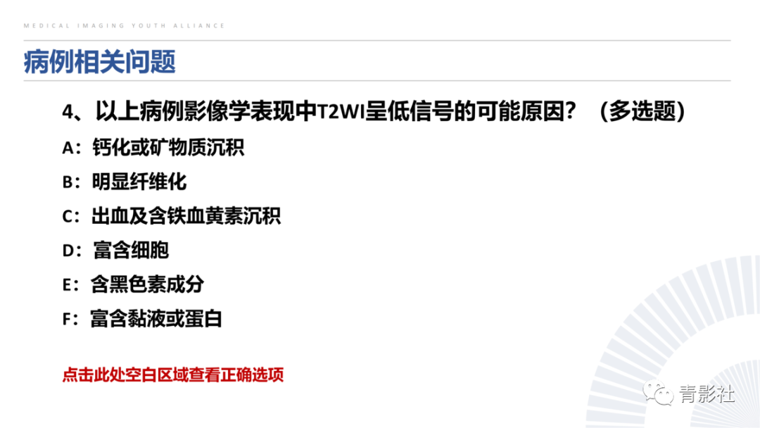 影像PPT - 【病例】蝶骨巨细胞修复性肉芽肿1例CT及MR影像-4