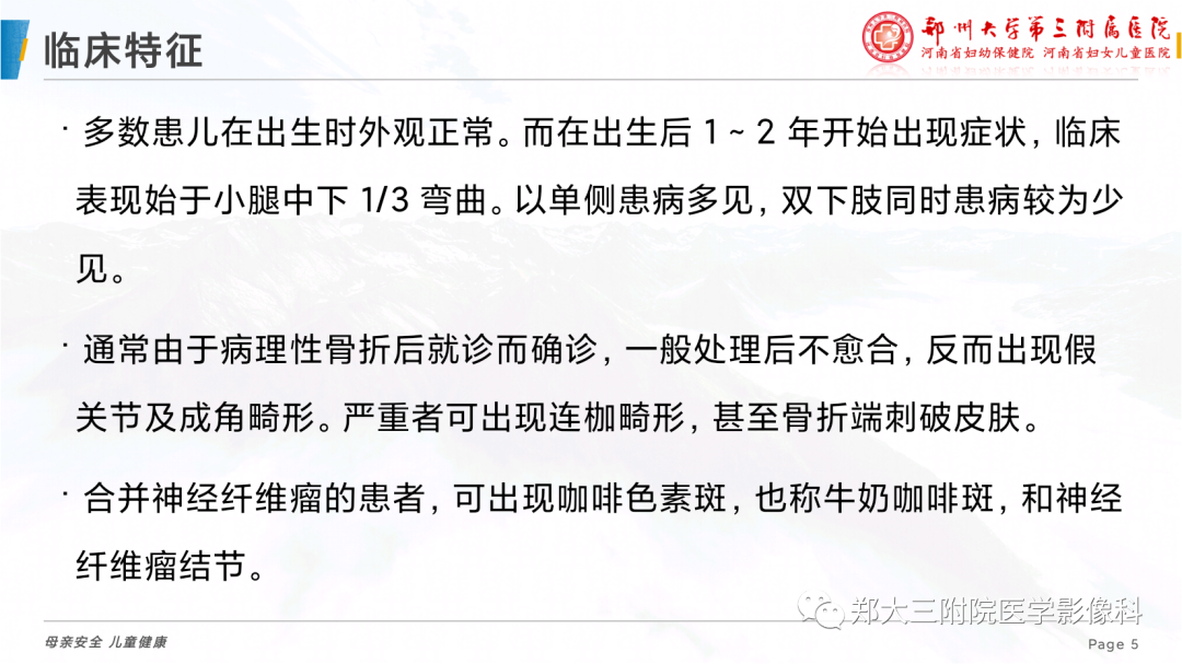 影像PPT - 【PPT】儿童先天性胫骨假关节-5