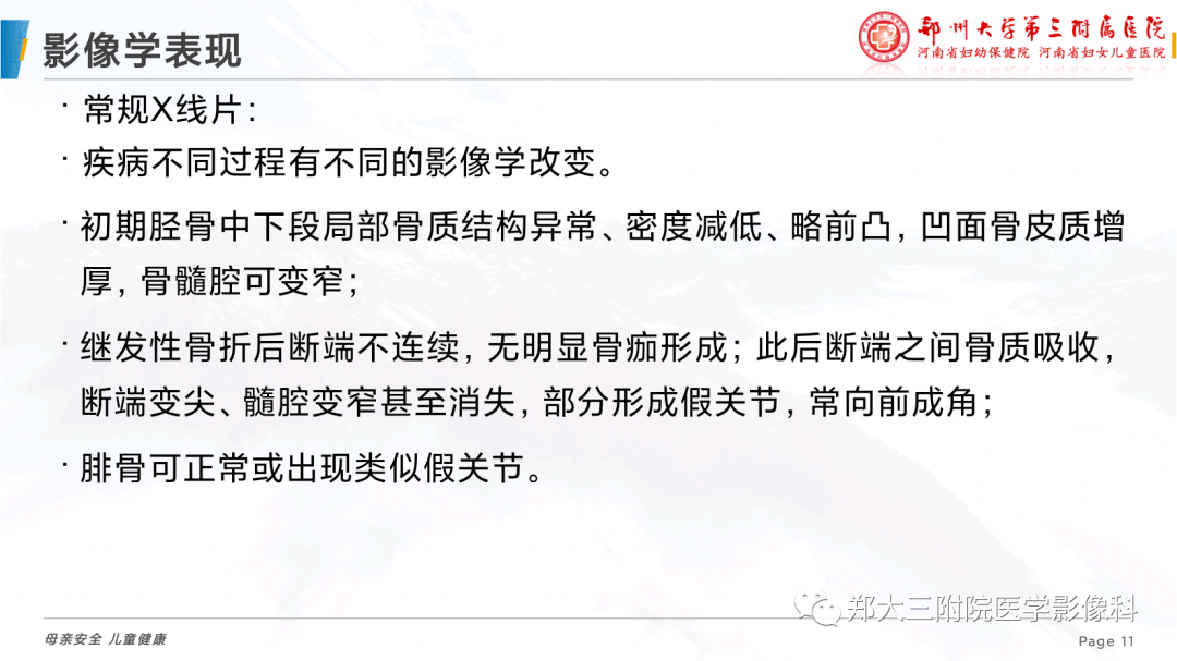 影像PPT - 【PPT】儿童先天性胫骨假关节-11