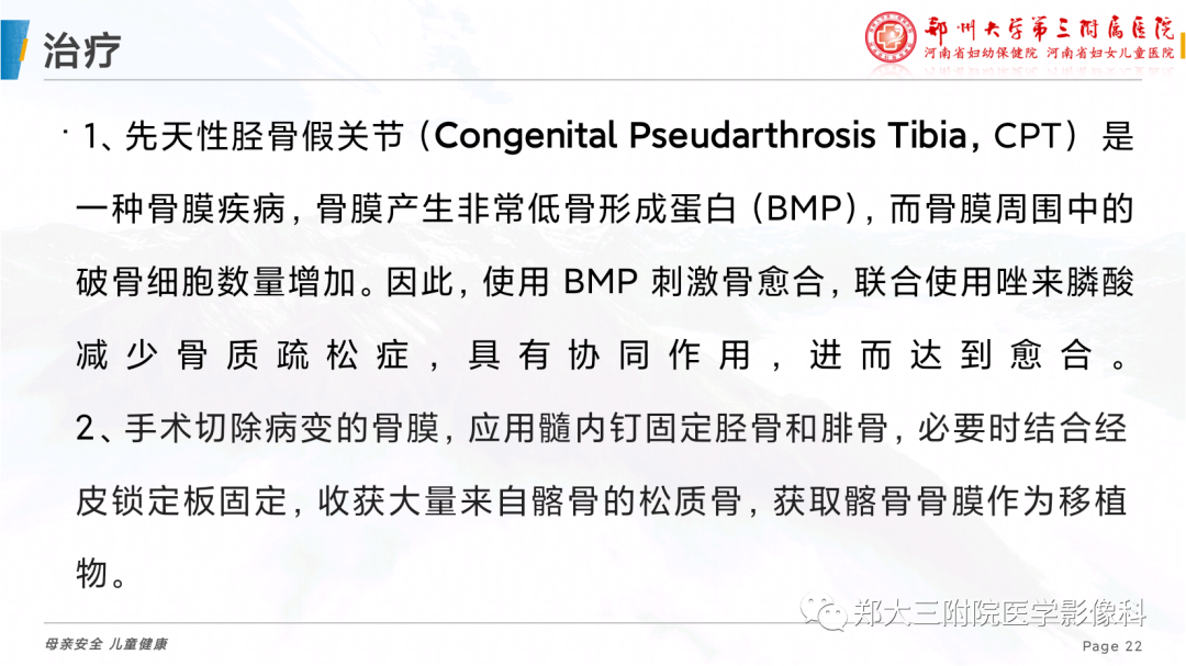 影像PPT - 【PPT】儿童先天性胫骨假关节-22