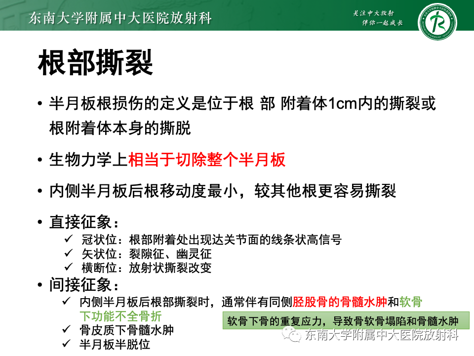 影像PPT - 【PPT】半月板撕裂-26