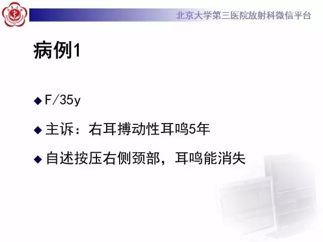 影像PPT - 【PPT】乙状窦前置-2
