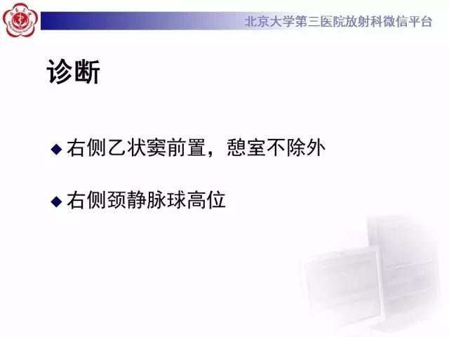 影像PPT - 【PPT】乙状窦前置-6