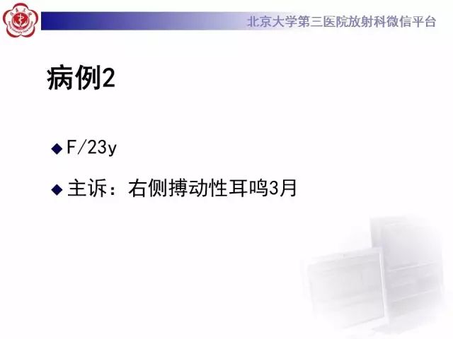 影像PPT - 【PPT】乙状窦前置-7
