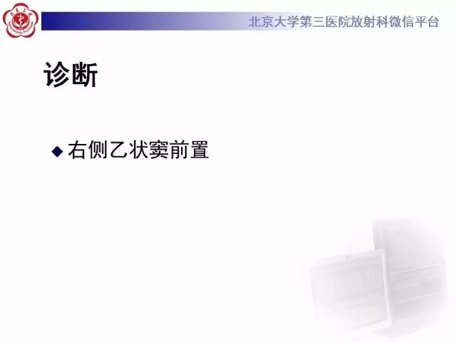 影像PPT - 【PPT】乙状窦前置-10