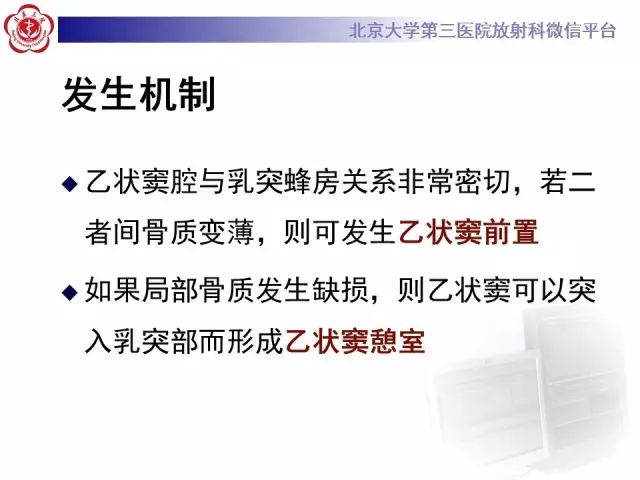 影像PPT - 【PPT】乙状窦前置-14