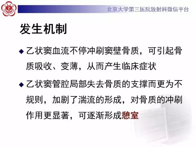 影像PPT - 【PPT】乙状窦前置-15