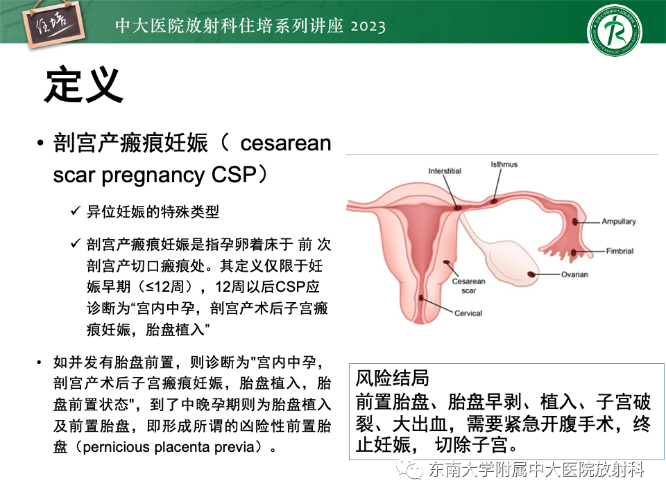 影像PPT - 【PPT】 剖宫产瘢痕妊娠-2