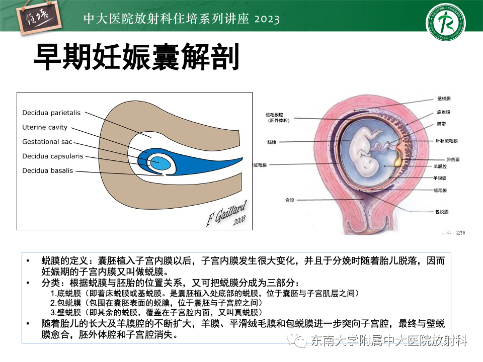 影像PPT - 【PPT】 剖宫产瘢痕妊娠-5