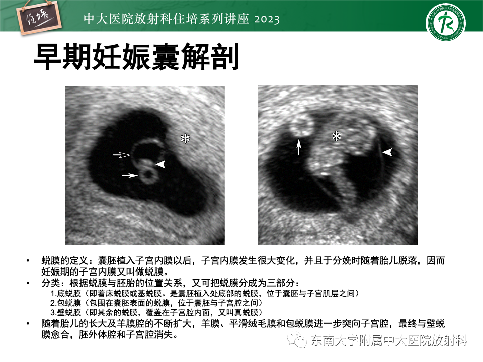 影像PPT - 【PPT】 剖宫产瘢痕妊娠-6