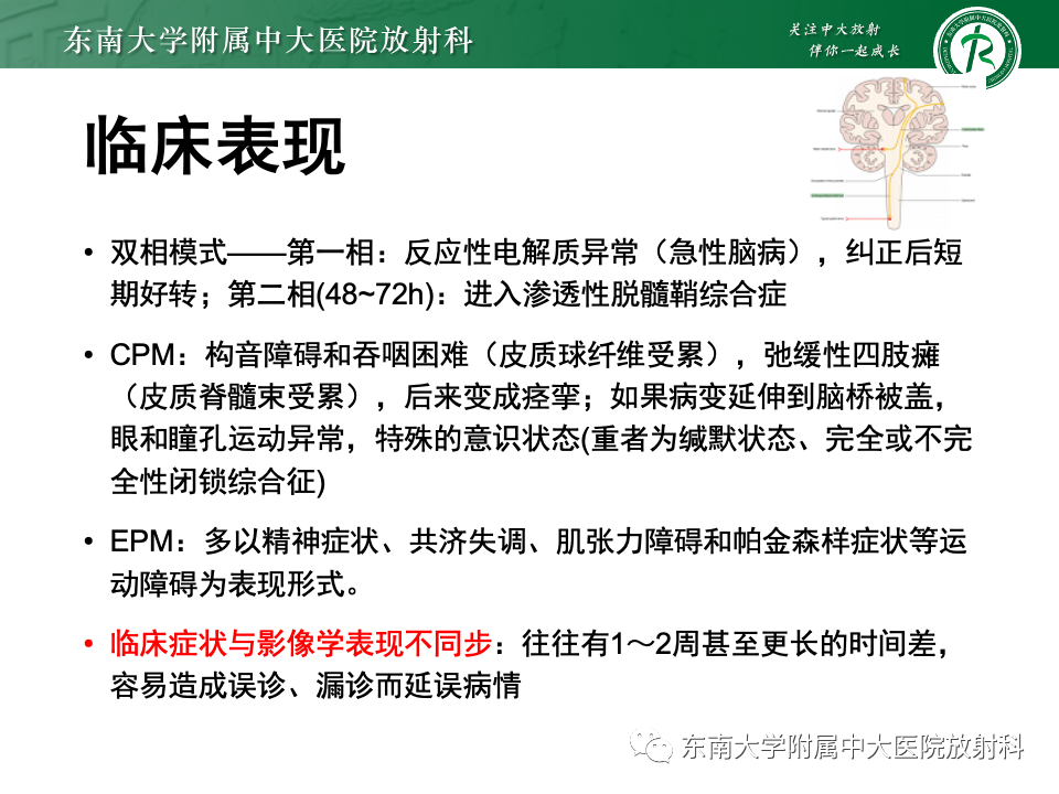 影像PPT - 【PPT】渗透性脱髓鞘综合征-16