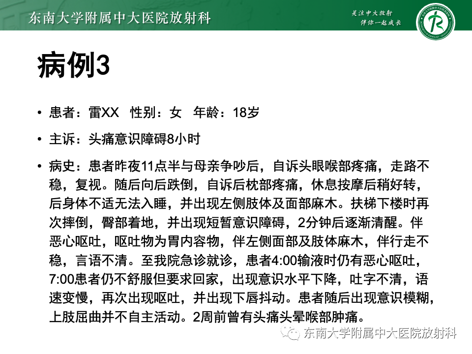影像PPT - 【PPT】渗透性脱髓鞘综合征-27