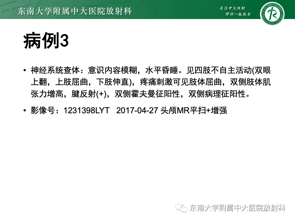 影像PPT - 【PPT】渗透性脱髓鞘综合征-28
