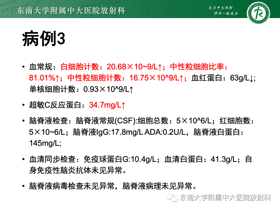 影像PPT - 【PPT】渗透性脱髓鞘综合征-30
