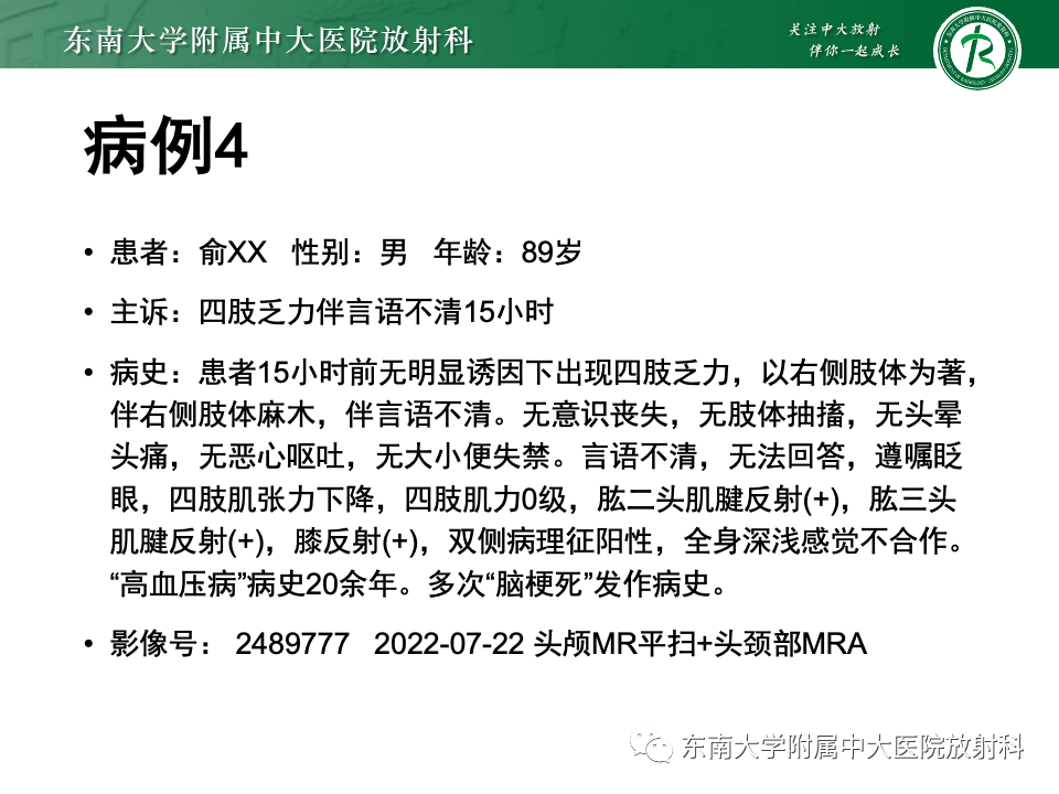 影像PPT - 【PPT】渗透性脱髓鞘综合征-34