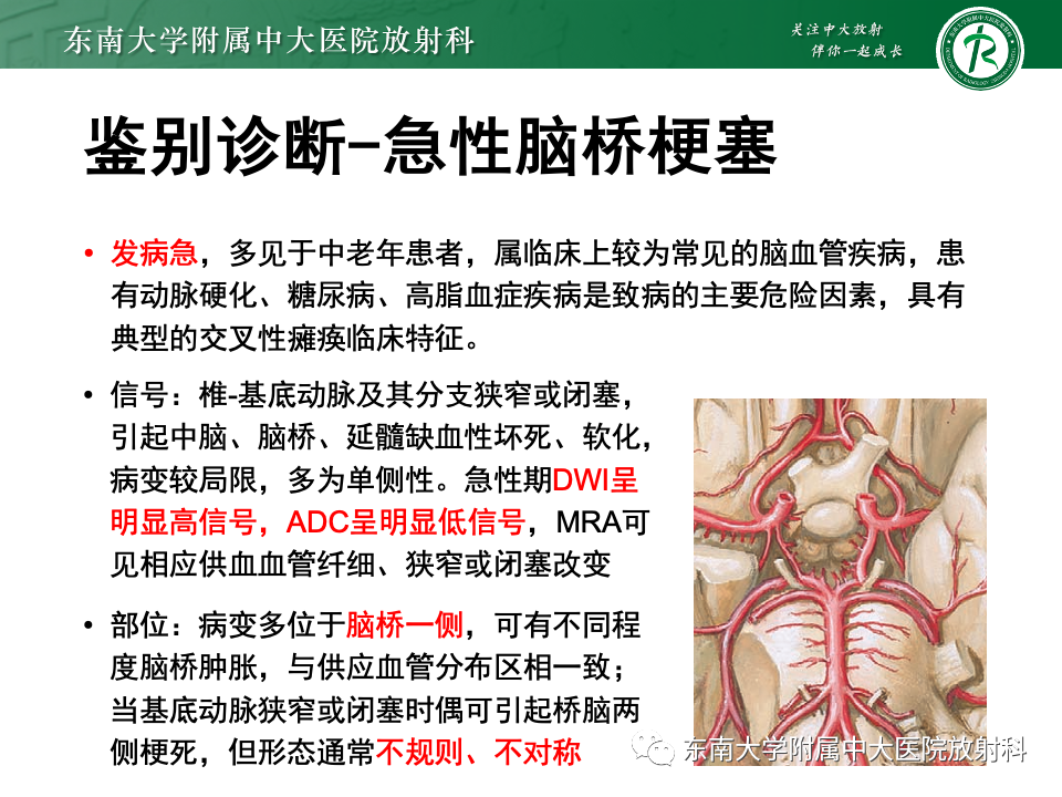 影像PPT - 【PPT】渗透性脱髓鞘综合征-36