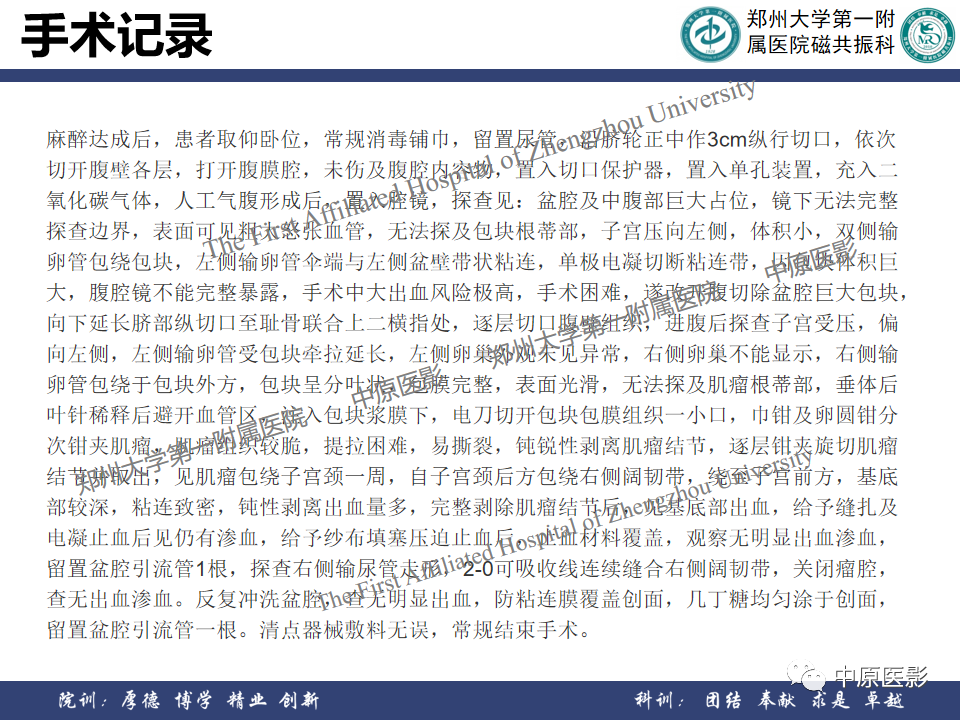 影像PPT - 【病例】子宫肌瘤1例MR影像-13