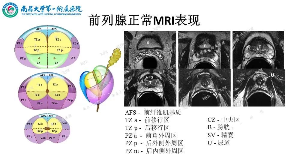 影像PPT - 【PPT】前列腺影像报告和数据系统 PI-RADS V2.1-4