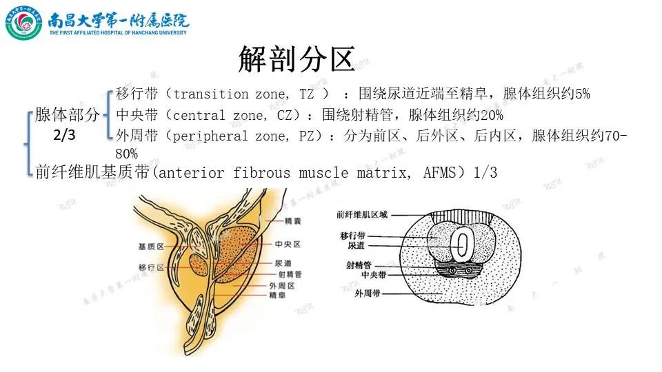 影像PPT - 【PPT】前列腺影像报告和数据系统 PI-RADS V2.1-3