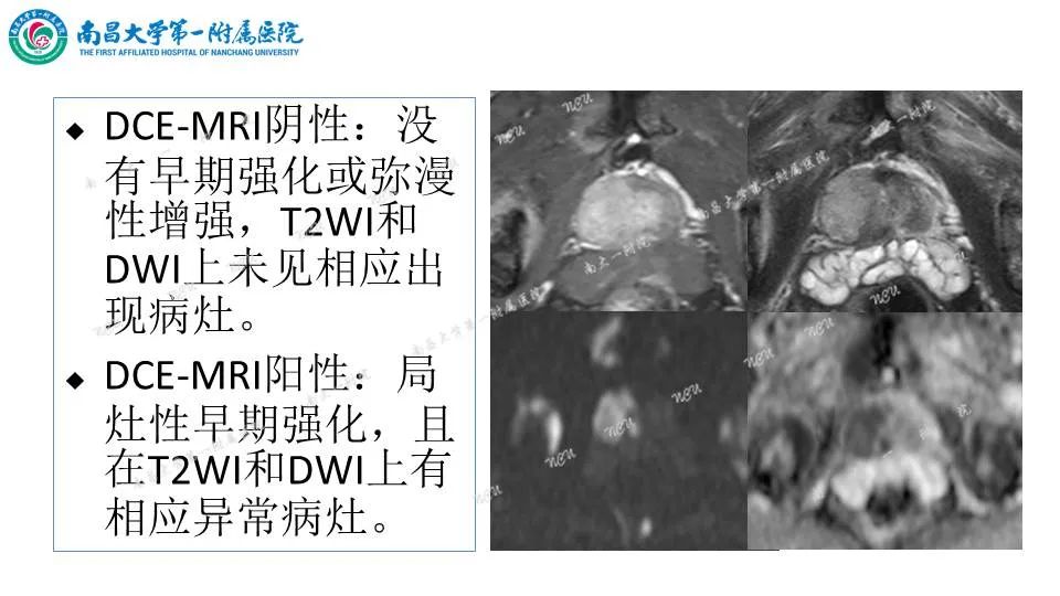 影像PPT - 【PPT】前列腺影像报告和数据系统 PI-RADS V2.1-14