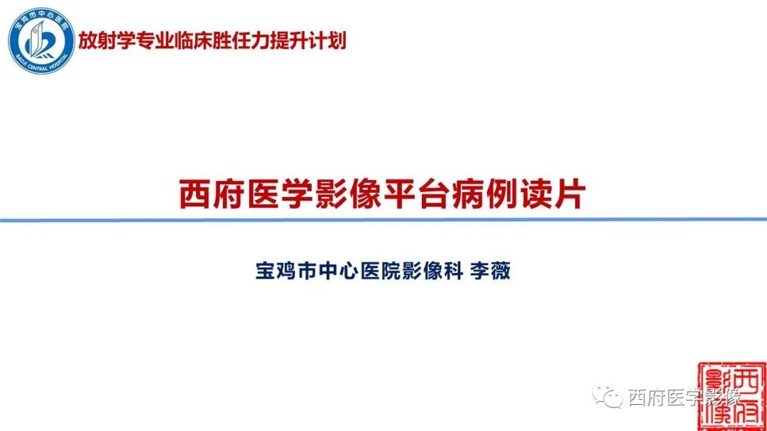 影像PPT - 【病例】锁骨下动脉盗血综合征1例CT影像-1