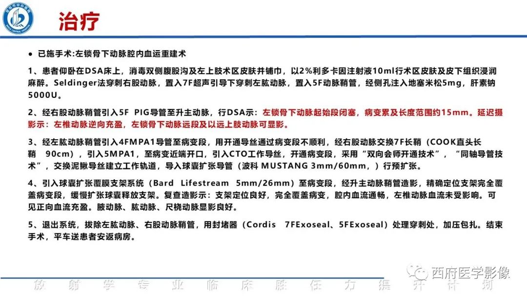影像PPT - 【病例】锁骨下动脉盗血综合征1例CT影像-8