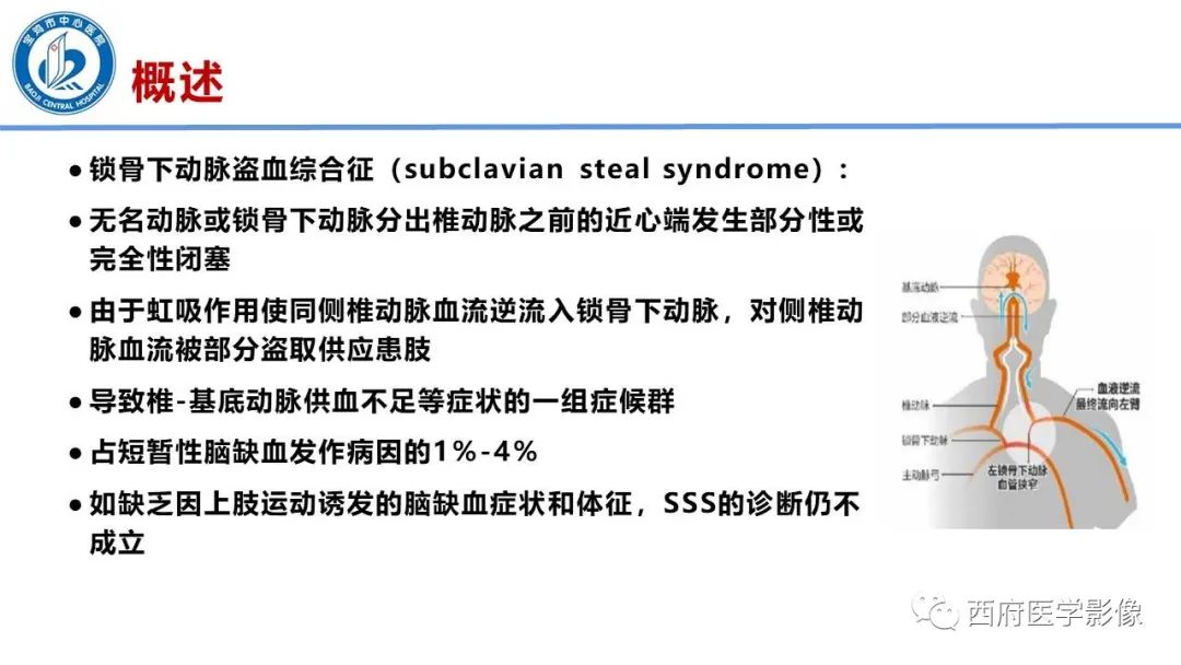 影像PPT - 【病例】锁骨下动脉盗血综合征1例CT影像-10