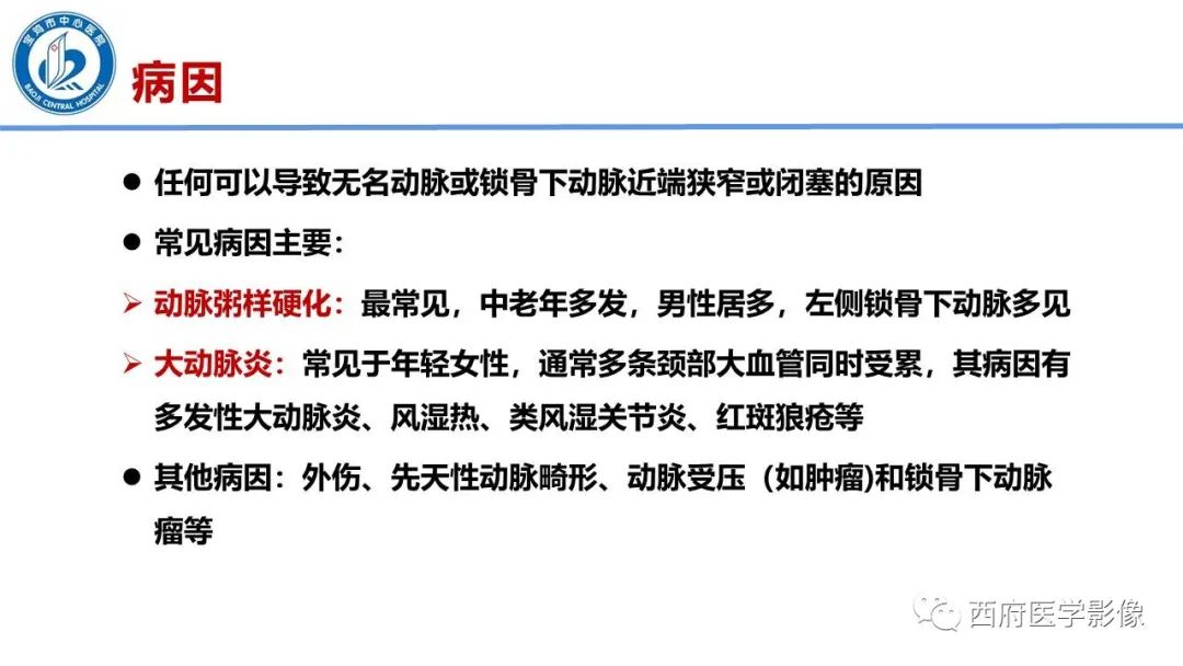 影像PPT - 【病例】锁骨下动脉盗血综合征1例CT影像-11