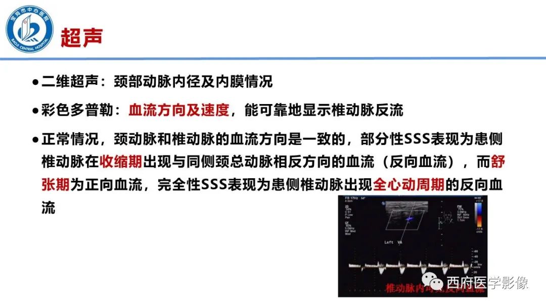 影像PPT - 【病例】锁骨下动脉盗血综合征1例CT影像-17