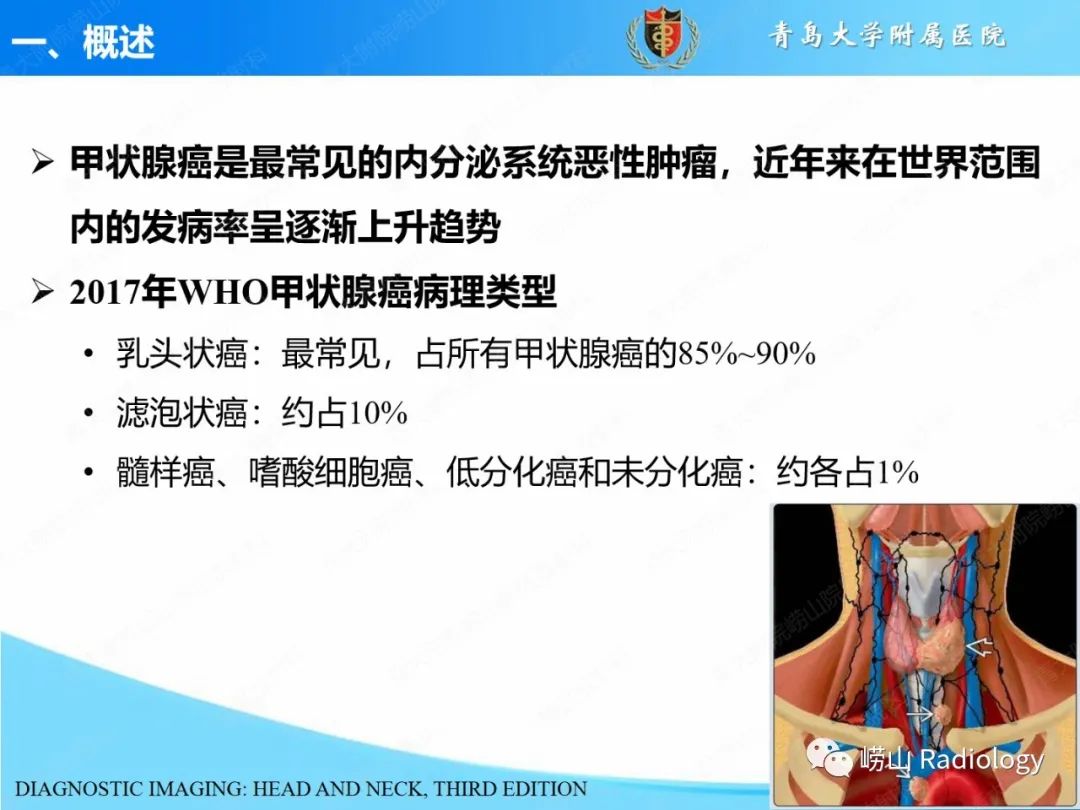 影像PPT - 【PPT】甲状腺癌及其转移淋巴结的影像诊断及鉴别诊断-3