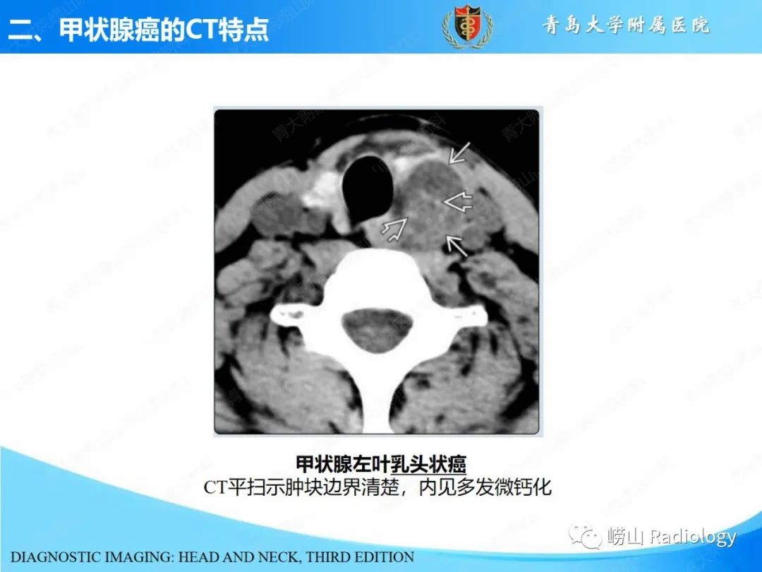影像PPT - 【PPT】甲状腺癌及其转移淋巴结的影像诊断及鉴别诊断-12